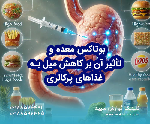 بوتاکس معده و تأثیر آن بر کاهش میل به غذاهای پرکالری