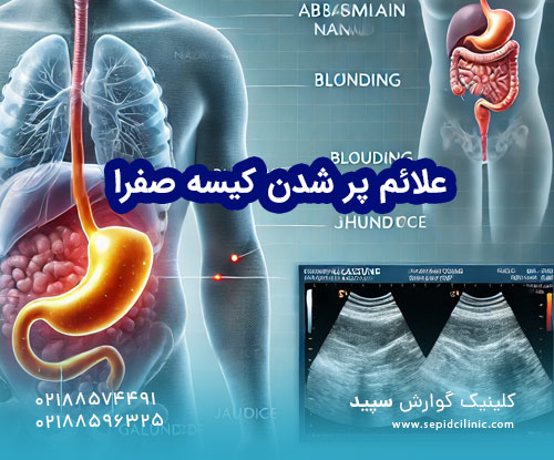 علائم پر شدن کیسه صفرا
