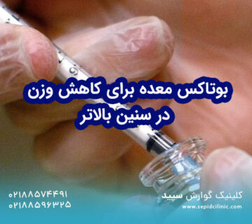 بوتاکس معده برای کاهش وزن در سنین بالاتر