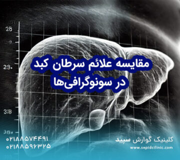 مقایسه علائم سرطان کبد در سونوگرافی‌های معمولی و تخصصی در غرب تهران