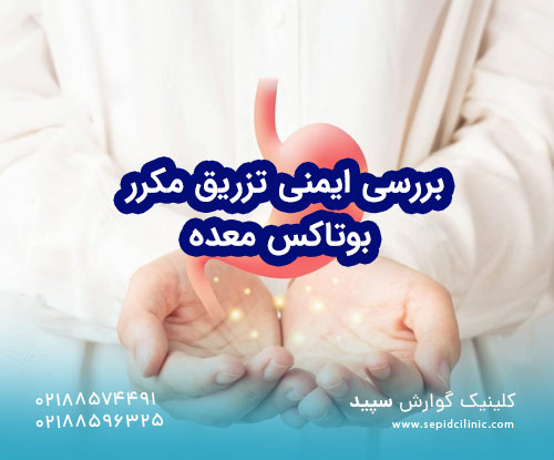 بررسی ایمنی تزریق مکرر بوتاکس معده