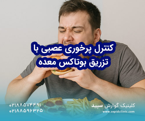 کنترل پرخوری عصبی باتزریق بوتاکس معده