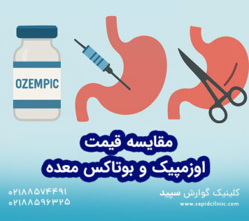 مقایسه هزینه اوزمپیک، بوتاکس معده و سایر روش های لاغری