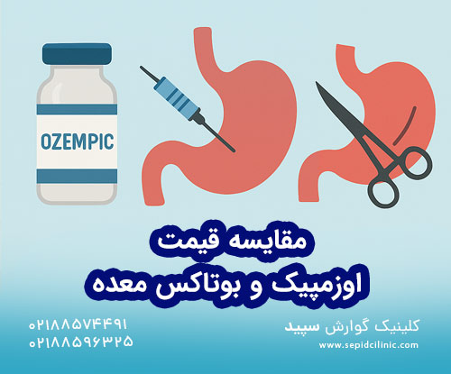 مقایسه هزینه اوزمپیک، بوتاکس معده و سایر روش های لاغری