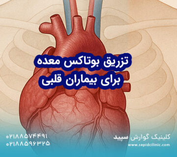 تزریق بوتاکس معده برای بیماران قلبی
