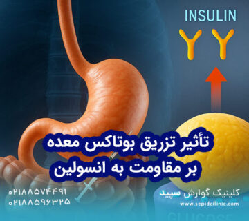 تأثیر تزریق بوتاکس معده بر مقاومت به انسولین