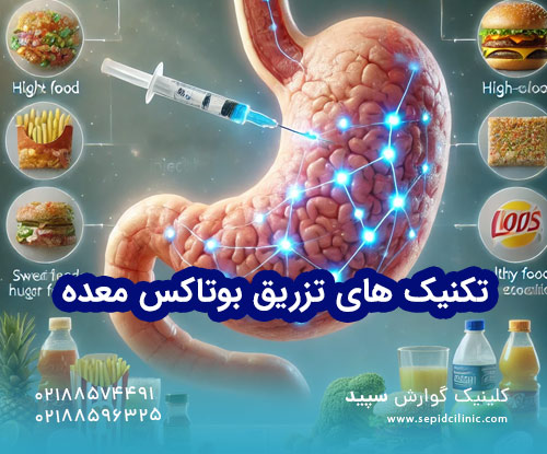 تکنیکهای تزریق بوتاکس معده