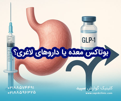 بوتاکس معده یا داروهای لاغری؟