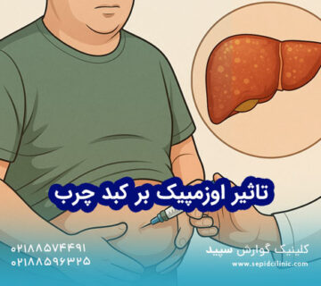 تأثیر اوزمپیک بر کبد چرب