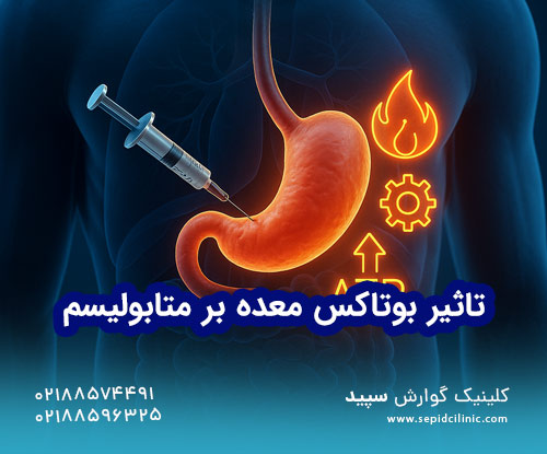 تاثیر تزریق بوتاکس معده بر متابولیسم بدن