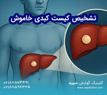 کیست کبدی خاموش