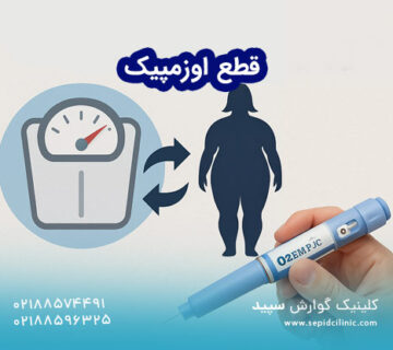 قطع اوزمپیک