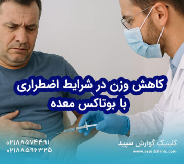 بوتاکس معده برای کاهش اشتها در شرایط اضطراری