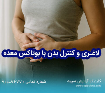 لاغری و کنترل بدن با بوتاکس معده