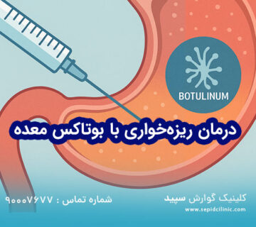 بوتاکس معده و ریزهخواری