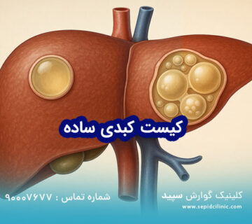 کیست ساده کبدی