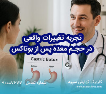 تجربه تغییرات واقعی در حجم معده پس از بوتاکس