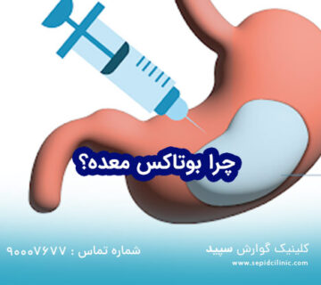 چرا بوتاکس معده