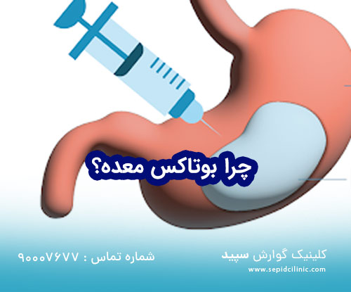 چرا بوتاکس معده