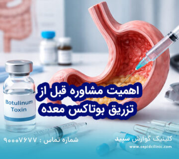 اهمیت مشاوره قبل از تزریق بوتاکس معده