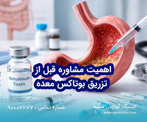 اهمیت مشاوره قبل از تزریق بوتاکس معده