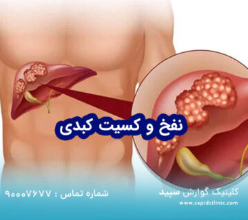 نفخ و کسیت کبدی