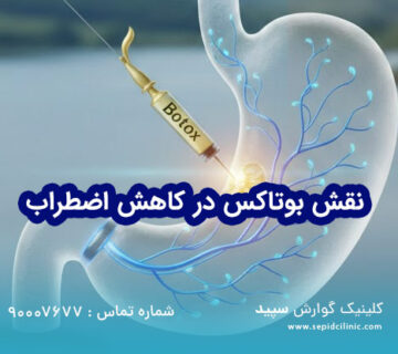 نقش بوتاکس معده در کاهش وزن و لاغری افراد مضطرب