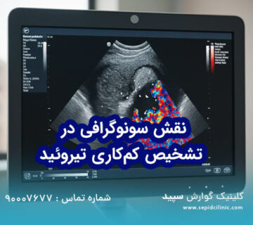 سونوگرافی برای تشخیص کم‌کاری تیروئید