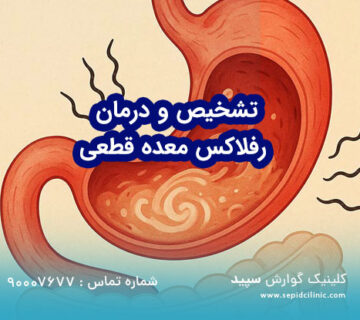 تشخیص و درمان رفلاکس معده قطعی