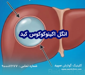 انگل اکینوکوکوس