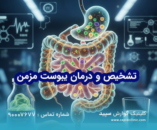 تشخیص و درمان یبوست مزمن