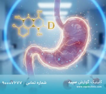 هم‌افزایی ویتامین D و بوتاکس معده