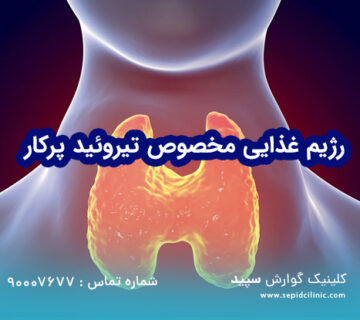 رژیم غذایی مخصوص