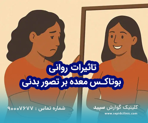 تاثیرات روانی بوتاکس معده بر تصور بدنی