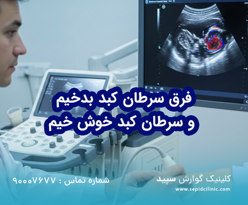 فرق سرطان کبد بدخیم و سرطان کبد خوش خیم