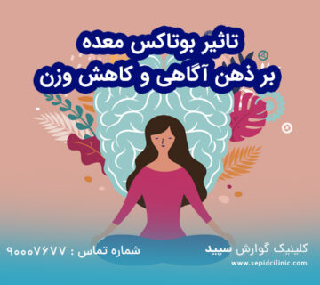 تاثیر بوتاکس معده بر ذهن آگاهی و کاهش وزن