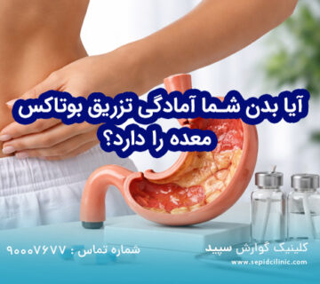 آیا بدن شما آمادگی تزریق بوتاکس معده را دارد؟