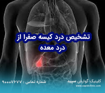 چرا درد کیسه صفرا را با معده‌درد اشتباه می‌گیریم؟