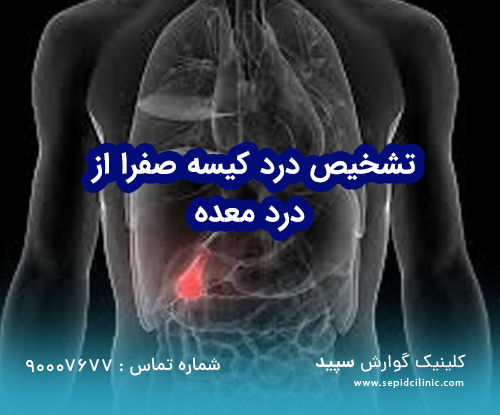 چرا درد کیسه صفرا را با معده‌درد اشتباه می‌گیریم؟