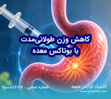 کاهش وزن طولانی‌مدت