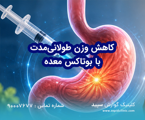 کاهش وزن طولانی‌مدت