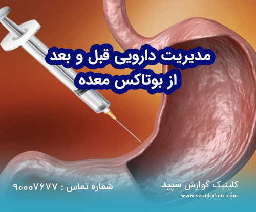 مدیریت دارویی قبل و بعد از بوتاکس معده