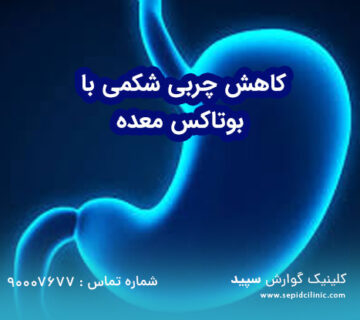 کاهش چربی شکمی با بوتاکس معده