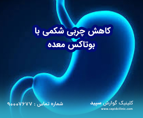 کاهش چربی شکمی با بوتاکس معده