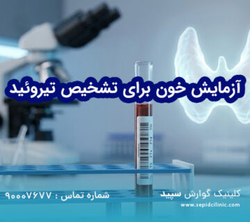 آزمایش خون برای تشخیص تیروئید