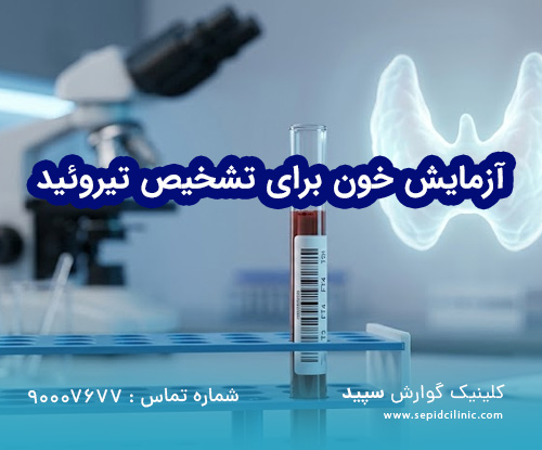 آزمایش خون برای تشخیص تیروئید