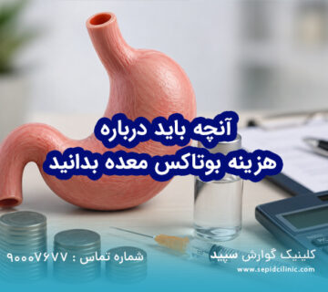 آنچه باید درباره هزینه بوتاکس معده بدانید