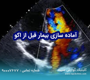 آماده‌سازی برای اکوکاردیوگرافی