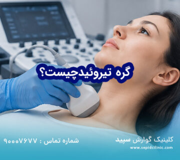 گره تیروئید