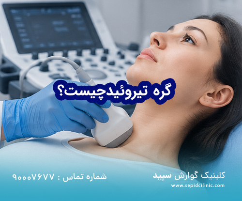 گره تیروئید